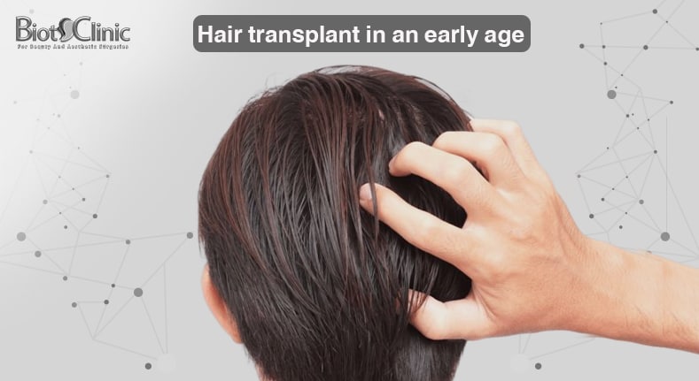 The best age for hair transplant? -