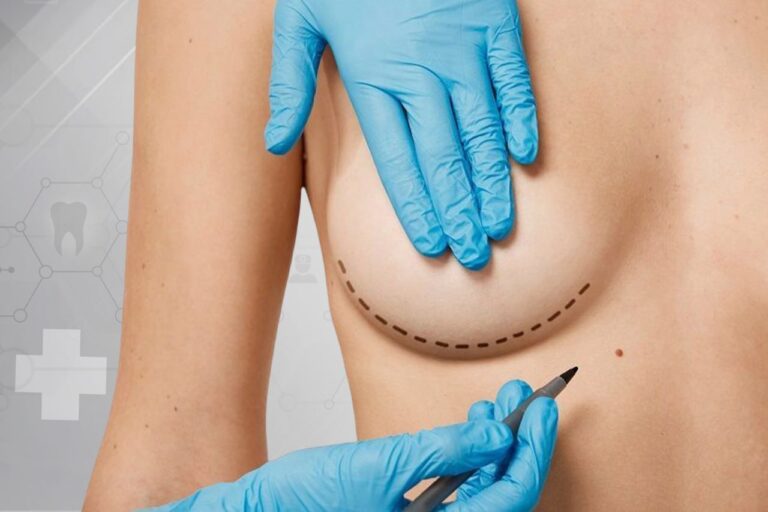 Breast Reduction
