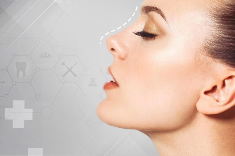 Rhinoplasty (Nose Job)