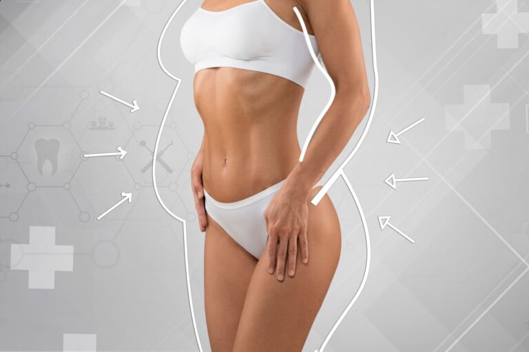 Breast Augmentation