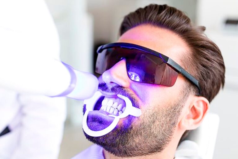 Teeth Whitening