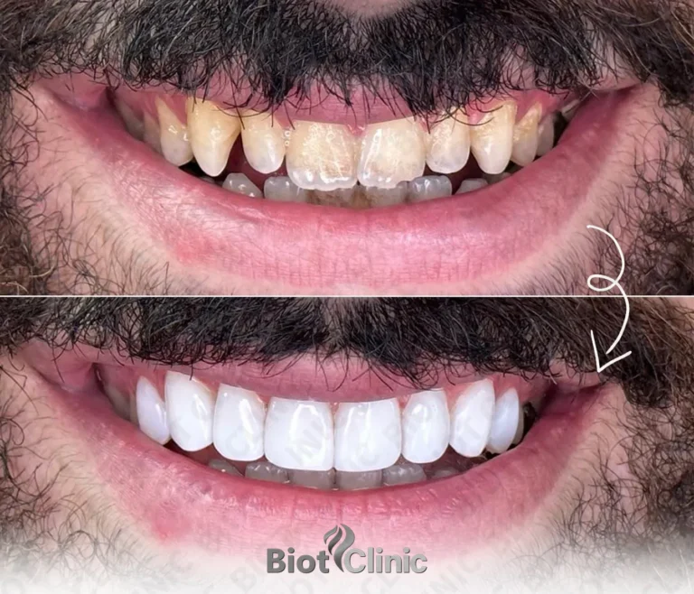 Happy Biot Clinic patient after treatment in Istanbul