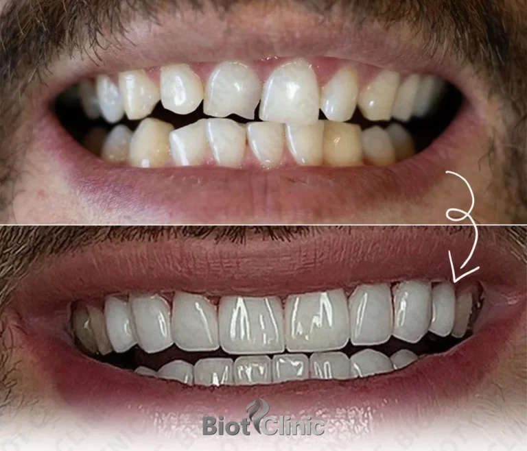 Happy Biot Clinic patient after treatment in Istanbul