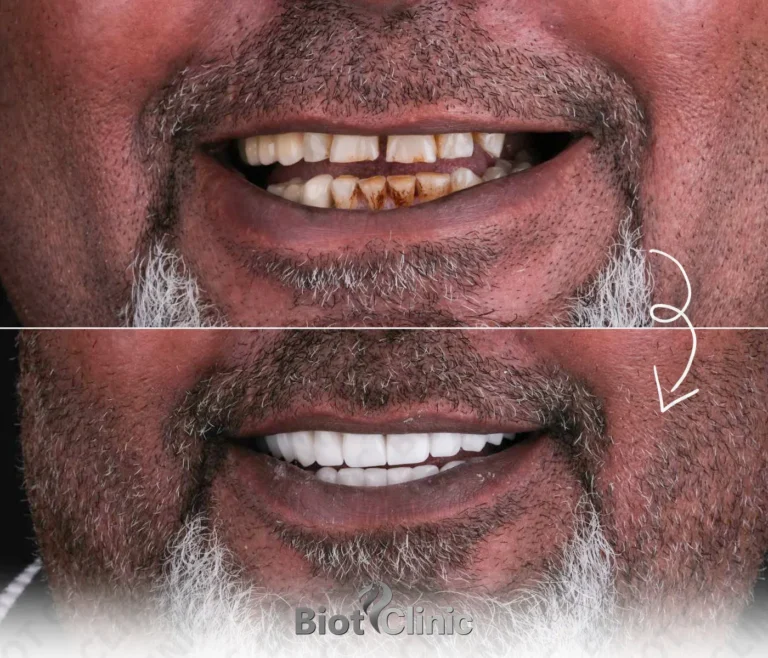 Happy Biot Clinic patient after treatment in Istanbul
