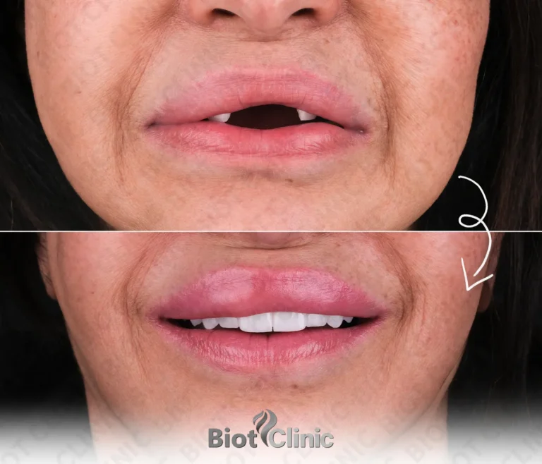 Happy Biot Clinic patient after treatment in Istanbul
