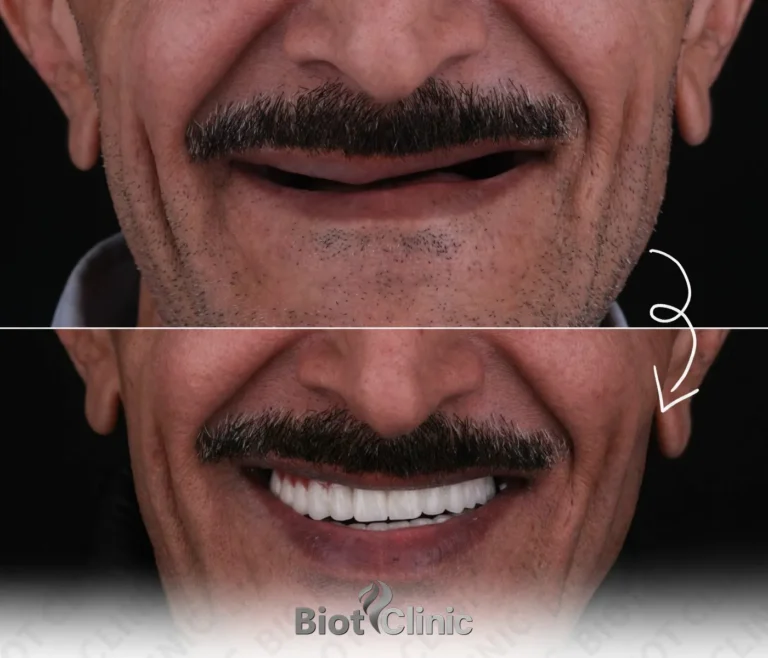 Happy Biot Clinic patient after treatment in Istanbul