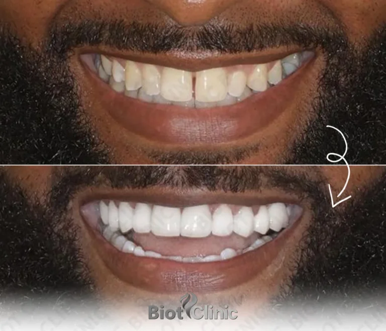Happy Biot Clinic patient after treatment in Istanbul