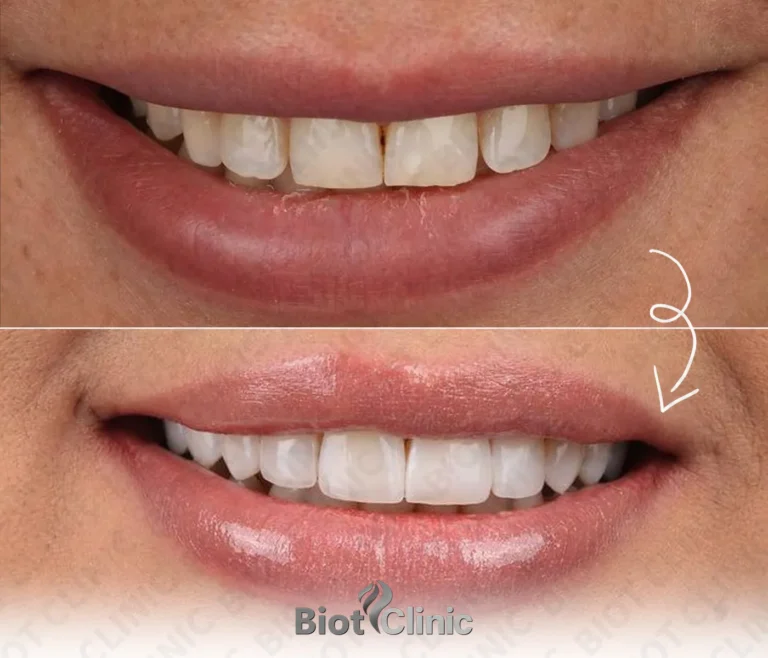 Happy Biot Clinic patient after treatment in Istanbul