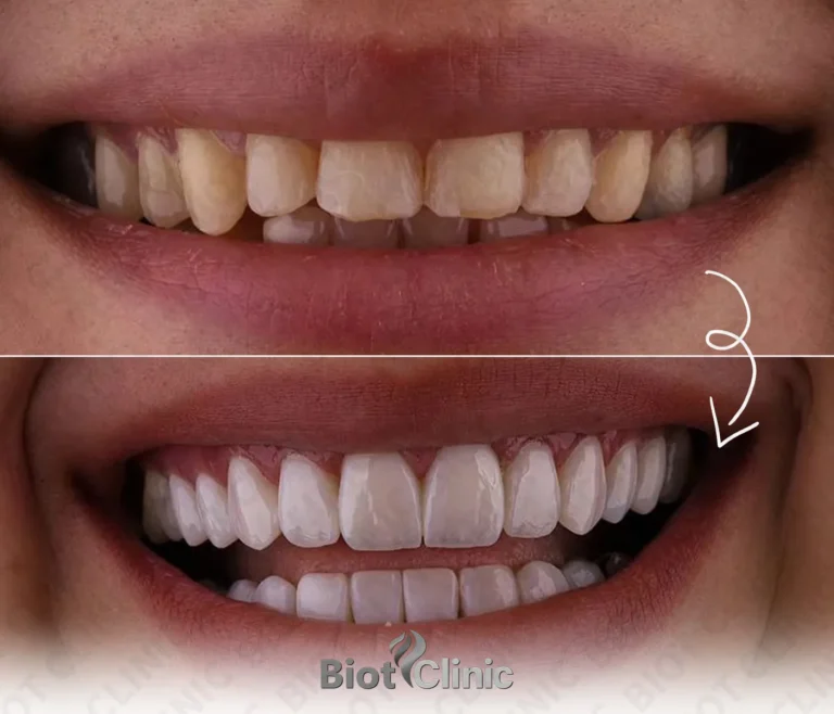 Happy Biot Clinic patient after treatment in Istanbul