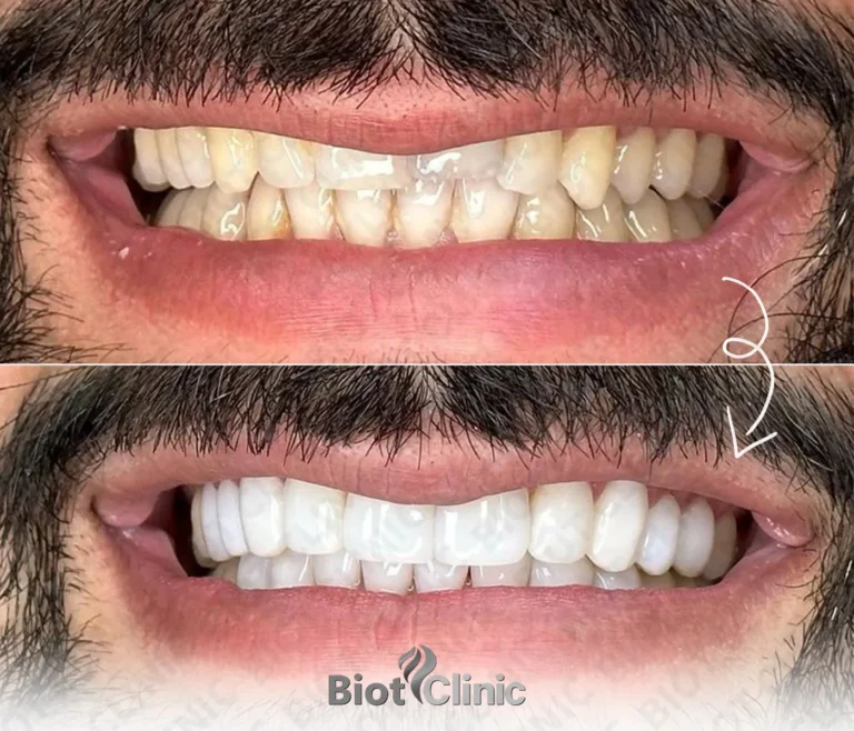 Happy Biot Clinic patient after treatment in Istanbul